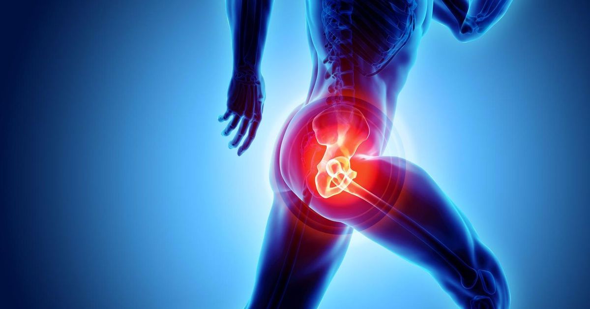 Kalça Kırığı Tedavisi