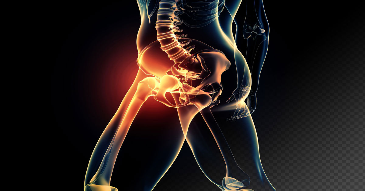 Kalçada Protez Ameliyatı