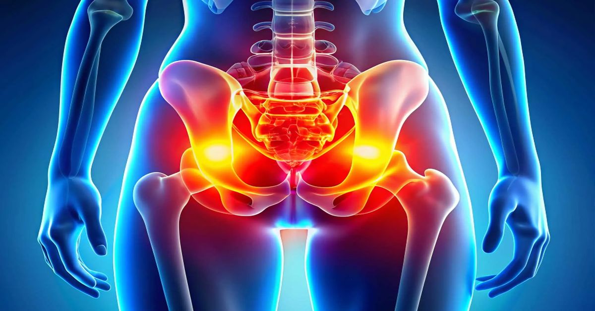 Kalçada Protez Ameliyatı