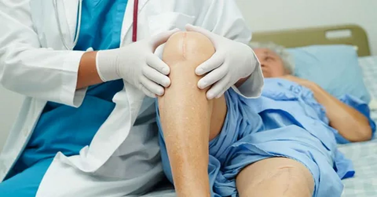 Diz Kırığı Tedavisi