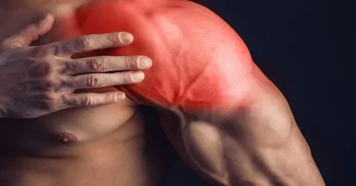 Kas Yırtığı Nedir?